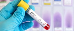 Epstein Barr Virus