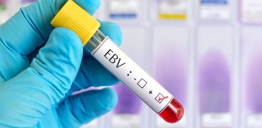 10 Very Important Things I Learned About Myself and Life By Having Chronic Epstein Barr Virus